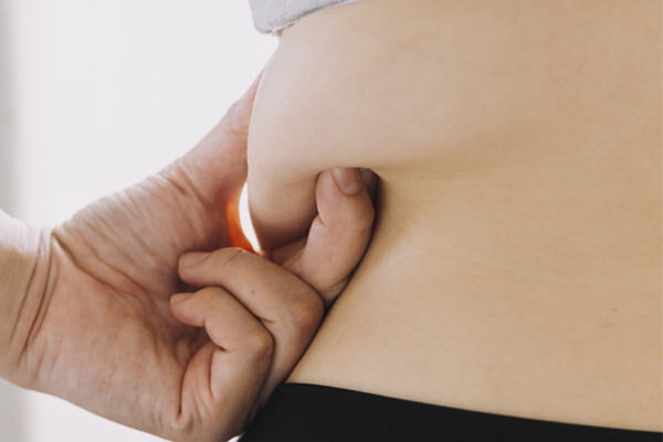 Liposuction Therapy